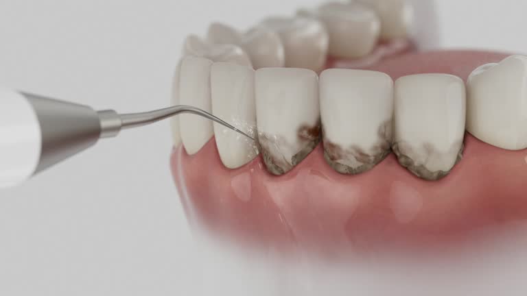 Reliable Dental contractor in Vinton, TX by Smile Center Dentistry